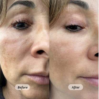 Bellini Ritual Relief Roll-On Oil (with Frankincense)